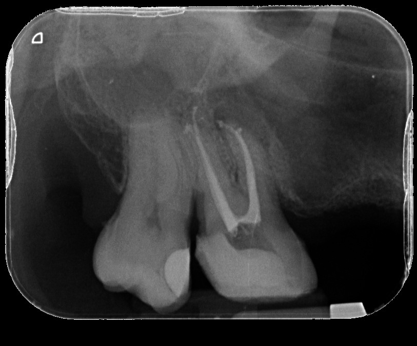 Radiografia Dentale